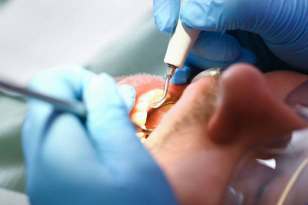 Best Emergency Cosmetic Dentistry (e.g., broken veneers) in Enon, VA