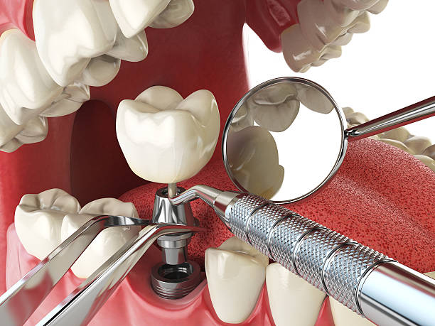 Best Walk-In Emergency Dental Services in Enon, VA